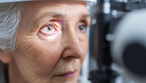 870 mil mexicanos en riesgo de ceguera irreversible por glaucoma, alertan 