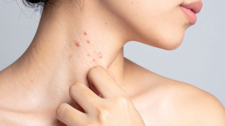 ¿Vacunarte contra el herpes zóster? Este inesperado efecto podría salvar tu corazón