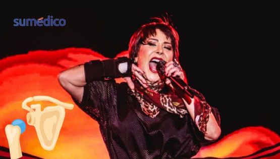 ¿Qué es dislocarse la cadera? Esto le sucedió a Alejandra Guzmán