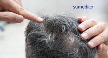 ¿Cuál es la verdadera razón por la que salen canas?