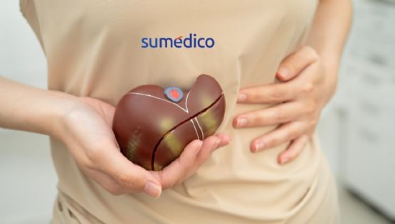 ¿Tienes hígado graso? Esta es la fruta que debes consumir