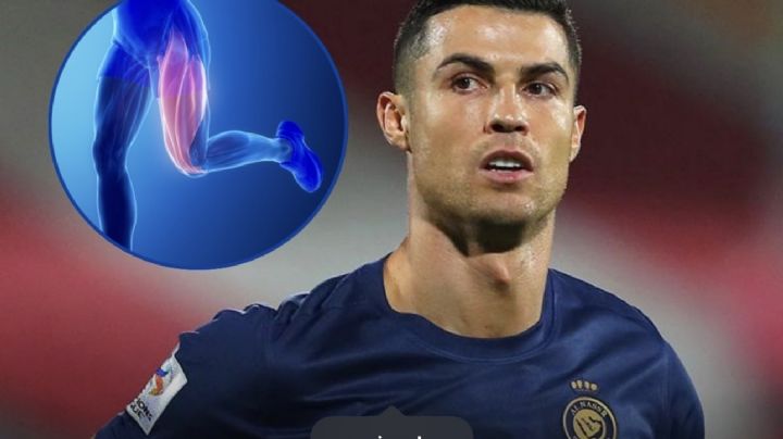 Cristiano Ronaldo: qué es la lesión en el tendón de la corva que le diagnosticaron