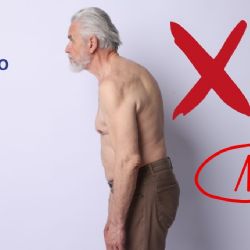 ¿Cómo prevenir que salga “joroba” con el paso de los años?