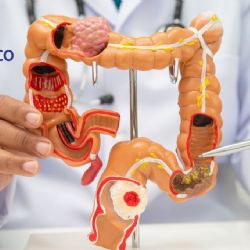 ¿Cómo limpiar el colon de forma eficaz?