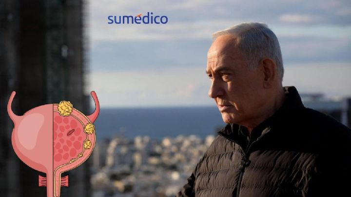 ¿Qué es el cáncer de próstata que padece Benjamin Netanyahu, primer ministro de Israel?
