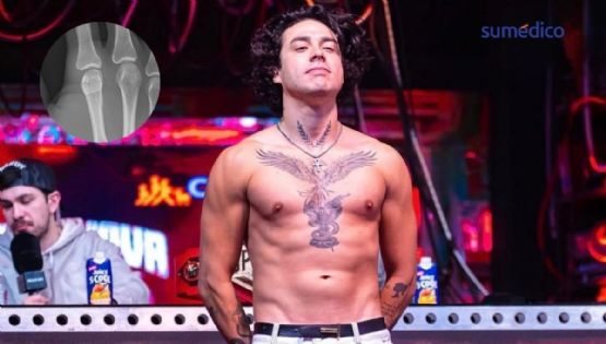 Mario Bautista tiene un nudillo roto: qué implica la lesión