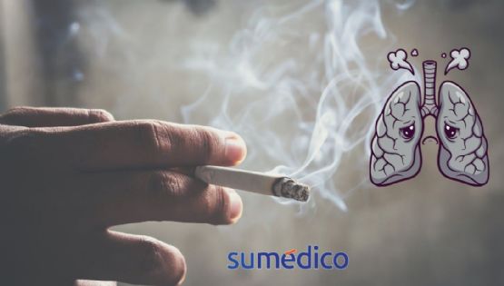 ¿Fumas? Estos son los cánceres que puedes padecer