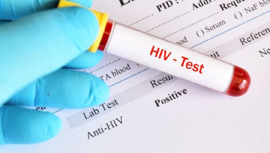 "Prevención combinada", la estrategia para frenar la transmisión del VIH