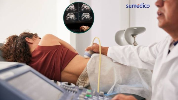 Fue al hospital por una apendicitis y descubrió, a los 46 años, que nació solo con un riñón
