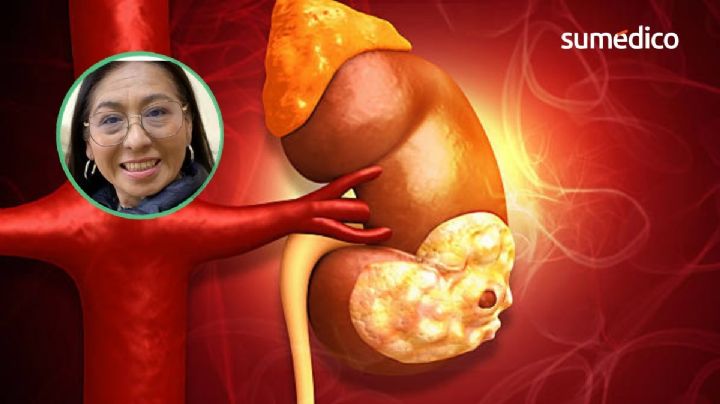"No me quiero morir, quiero seguir viviendo para abrazarlos": la lucha de Norma contra el cáncer de riñón