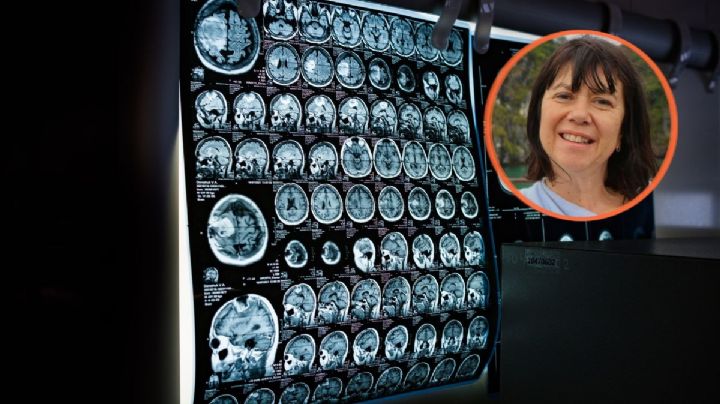 A Michelle le dijeron que era la menopausia, en realidad tenía cáncer cerebral 