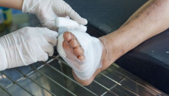 La clínica con tecnología de vanguardia para el tratamiento del pie diabético