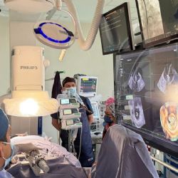 Con tecnología mínimamente invasiva, combaten insuficiencia mitral en Cardiología