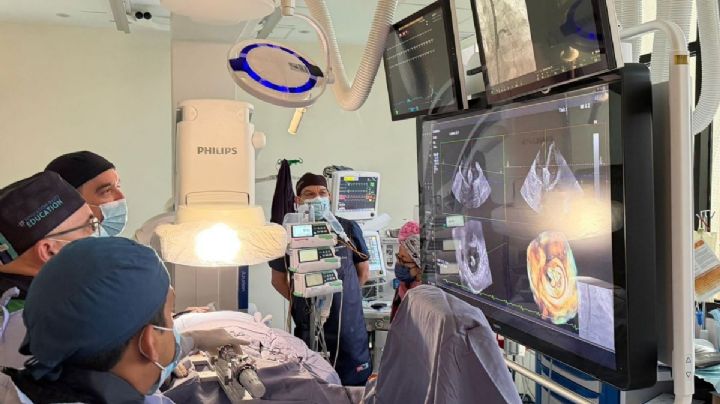 Con tecnología mínimamente invasiva, combaten insuficiencia mitral en Cardiología
