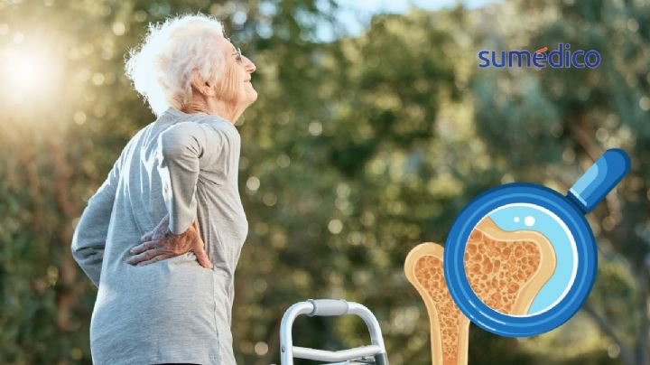 ¿Qué es la osteoporosis y por qué es fundamental prevenirla?