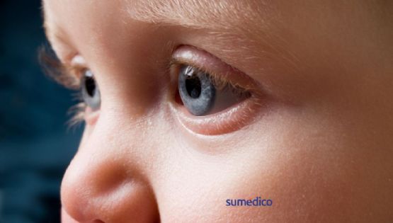 ¿Por qué salen lagañas a los bebés y cómo eliminarlas?