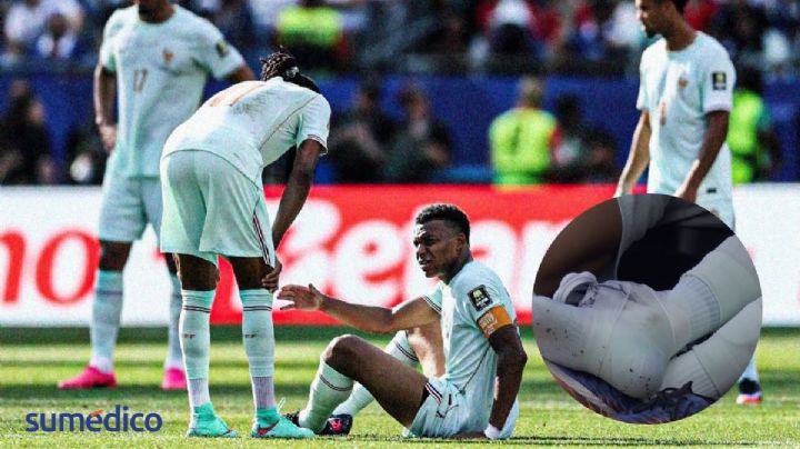 ¿Jugará Mbappé la semifinal del Mundial? Esto se sabe sobre su supuesta lesión