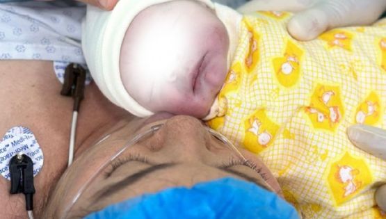 Leo, el recién nacido que lucha por una cirugía de esófago