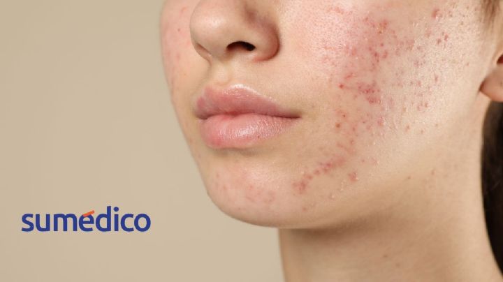 Las señales que da tu piel de que algo NO anda bien en tu salud