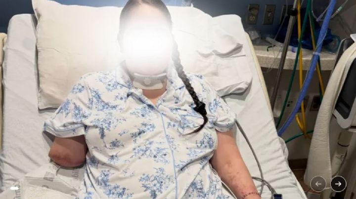 De una gripe a perder las piernas y un brazo: La lucha de Kaydin por un nuevo comienzo