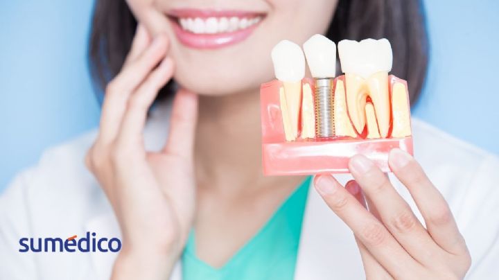 Salud dental: claves para una sonrisa fuerte y duradera