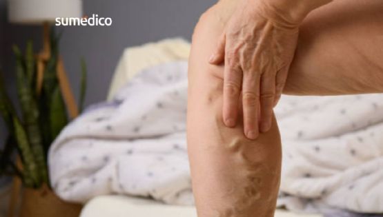 El síntoma en las piernas que muchos ignoran y puede ser mortal