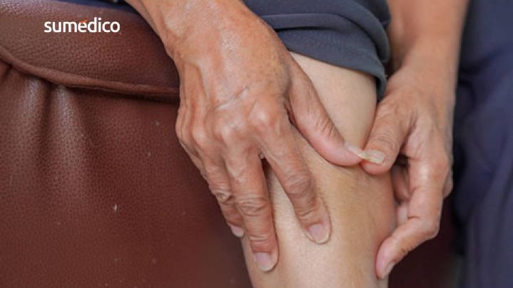 El efecto oculto de la menopausia en tus piernas