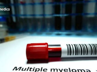 Bristol Myers abre nueva clase de tratamientos contra el mieloma múltiple