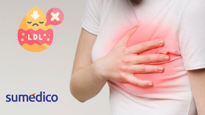 5 malos hábitos que elevan el colesterol