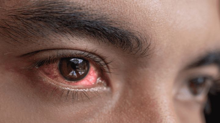Traumas oculares, la ventana a otros problemas visuales

