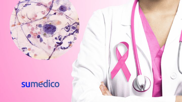 Conciencia sobre cáncer cervicouterino