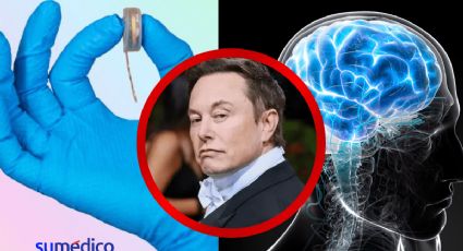 FDA autoriza a empresa de Elon Musk implantar chip cerebral en un segundo paciente