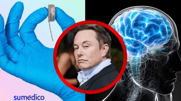 FDA autoriza a empresa de Elon Musk implantar chip cerebral en un segundo paciente