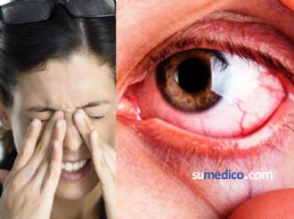 Mexicanos con mayor predisposición al glaucoma