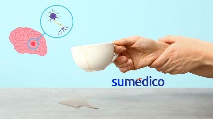 ¿Cómo detectar el Parkinson hasta 30 años antes de los síntomas?