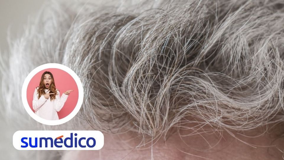 Estas razones también están detrás de la aparición de canas.