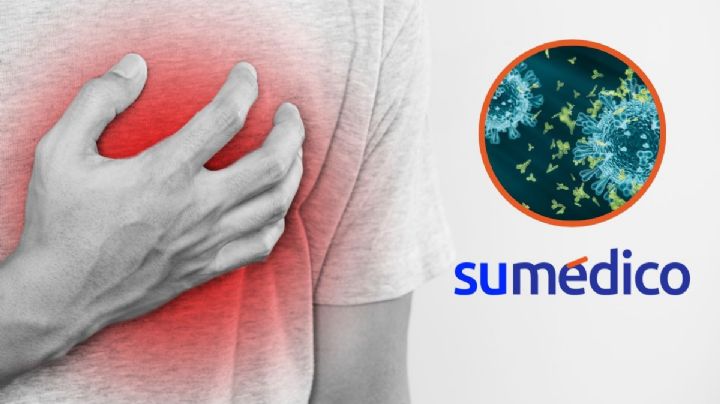 Este mecanismo podría explicar el aumento de riesgo en infartos por covid-19