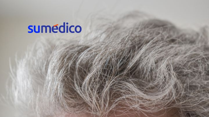¿Por qué nos salen canas?, expertos de Harvard explican que no es solo por edad