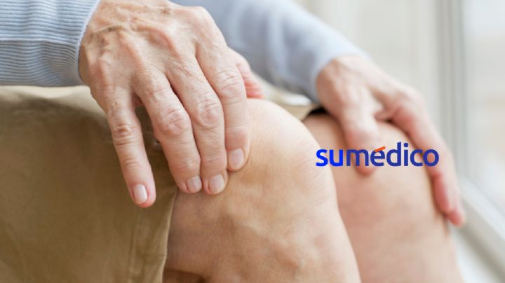 Osteoporosis: enfermedad que podría afectar a 37% de los mexicanos para 2050