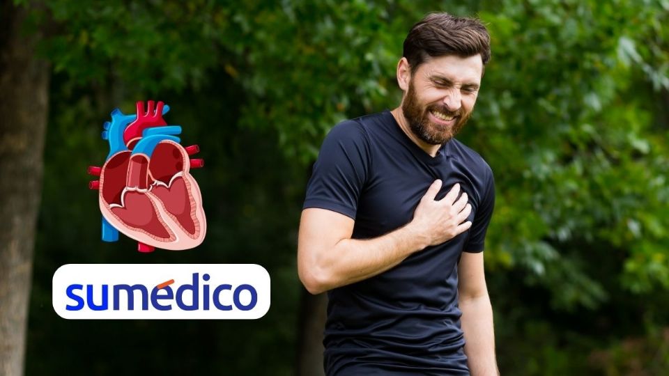 ¿Qué conocemos sobre la cardiomiopatía arritmogénica?