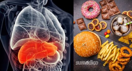 5 peores alimentos para el hígado y con qué sustituirlos