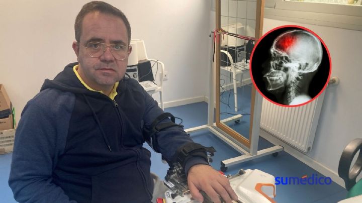 “A raíz del covid sufro de presión alta y ello me llevó a un ictus hemorrágico”