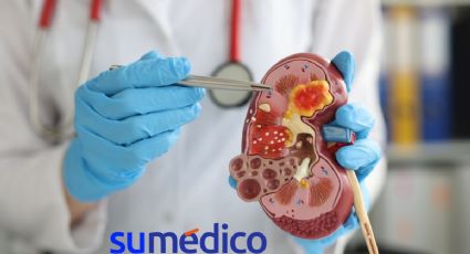 ¿Cuáles son las claves para evitar la enfermedad renal?