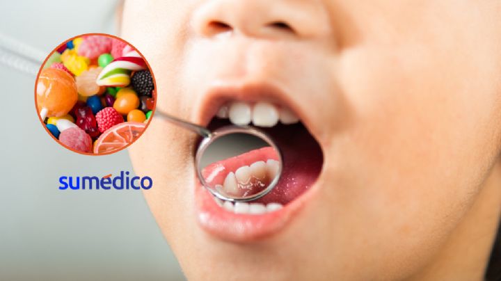 Así puedes cuidar los dientes de tus hijos en Halloween