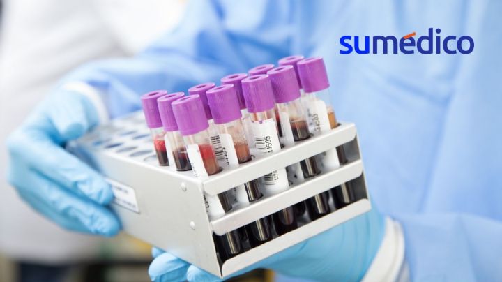 Así es el estudio para detectar cáncer en asintomáticos con sólo una muestra de sangre