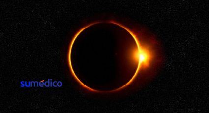 Esto es lo que puede pasar si miras el eclipse solar directamente