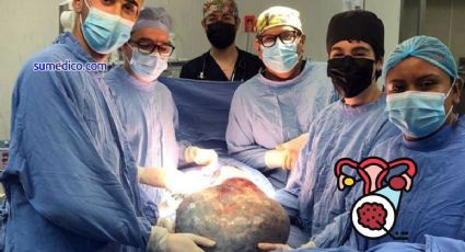 Retiran tumor ovárico gigante de 21 kg a mujer de 60 años