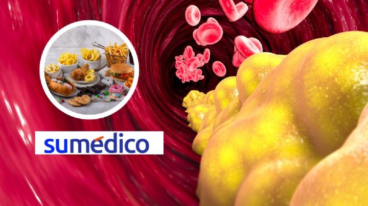 Estos son los alimentos que no te dejan bajar los triglicéridos altos