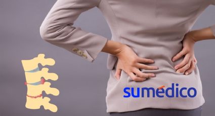 Surge un nuevo parche para reparar una hernia discal