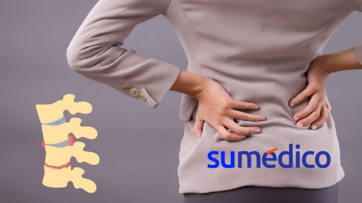Surge un nuevo parche para reparar una hernia discal